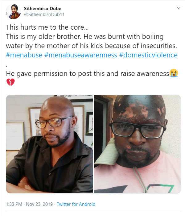Viral News - Man raises awareness of domestic violence against men after his wife baptized him with hot water